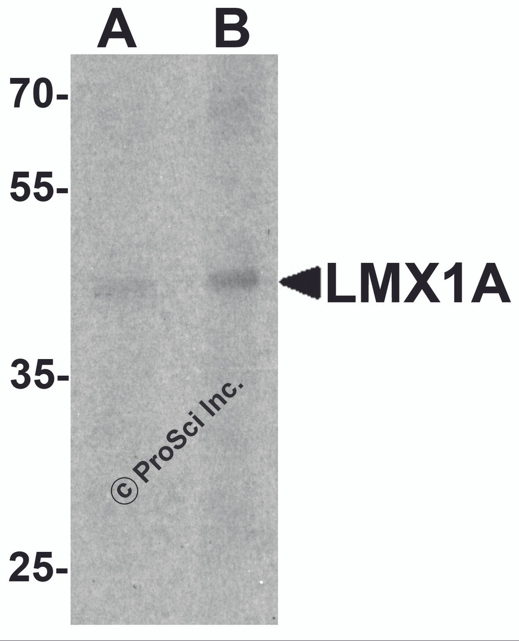 Western blot analysis of LMX1A in rat brain tissue lysate with LMX1A antibody at (A) 1 and (B) 2 &#956;g/mL.