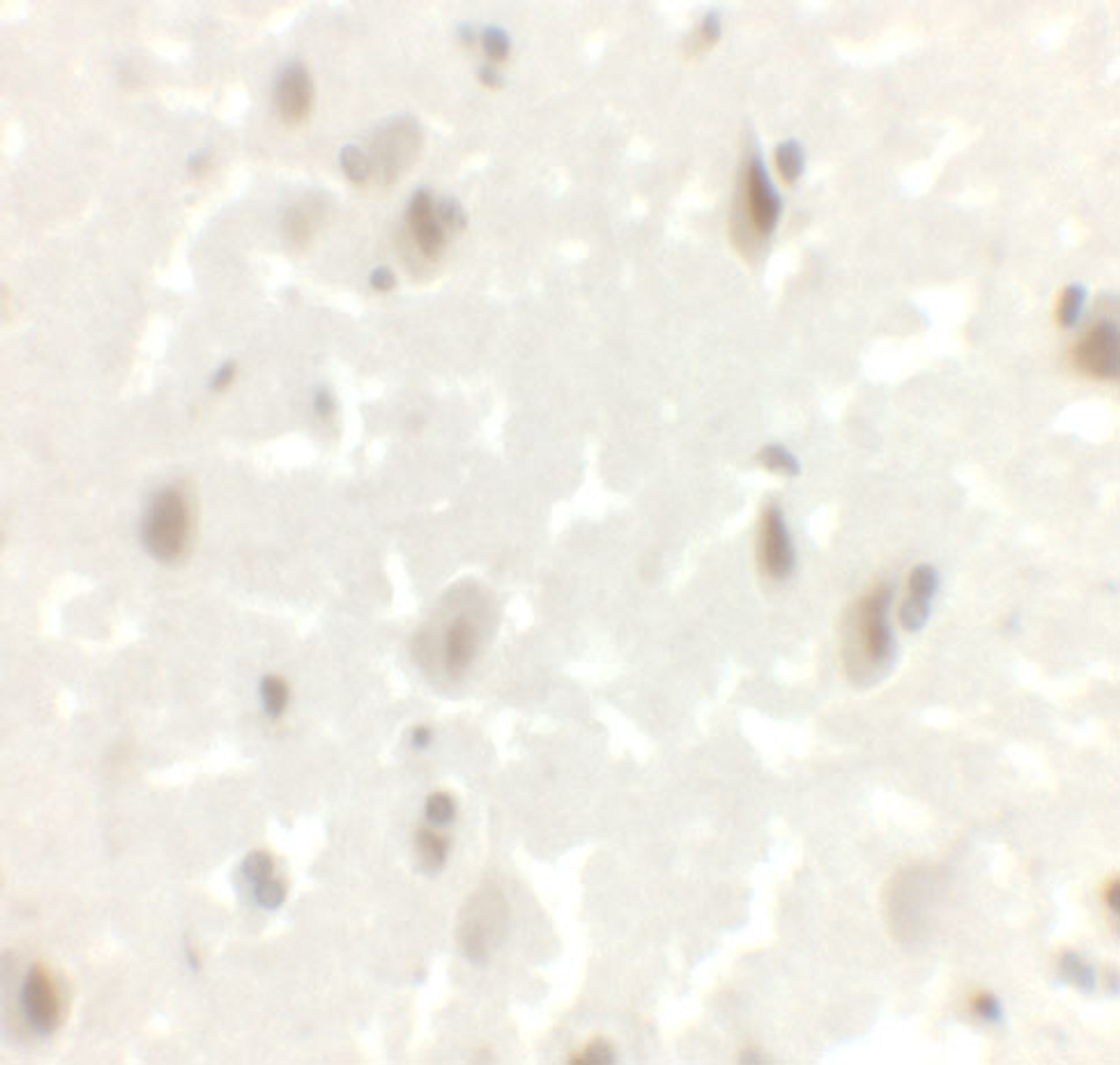 Immunohistochemistry of LMX1A in human brain tissue with LMX1A antibody at 2.5 ug/mL.