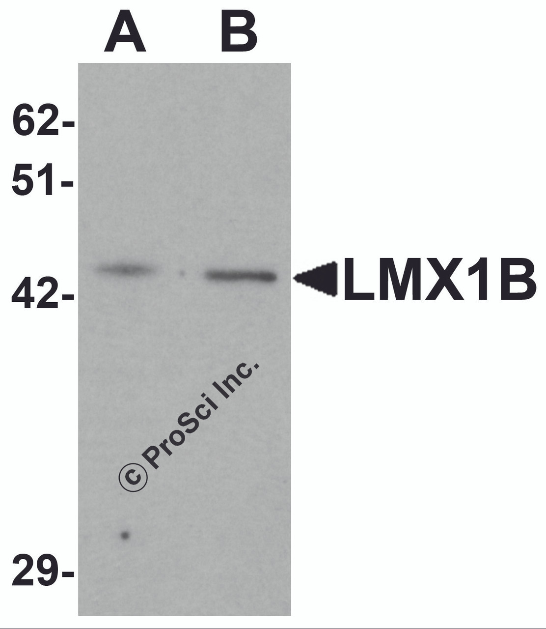 Western blot analysis of LMX1B in A-20 cell lysate with LMX1B antibody at (A) 1 and (B) 2 &#956;g/mL.
