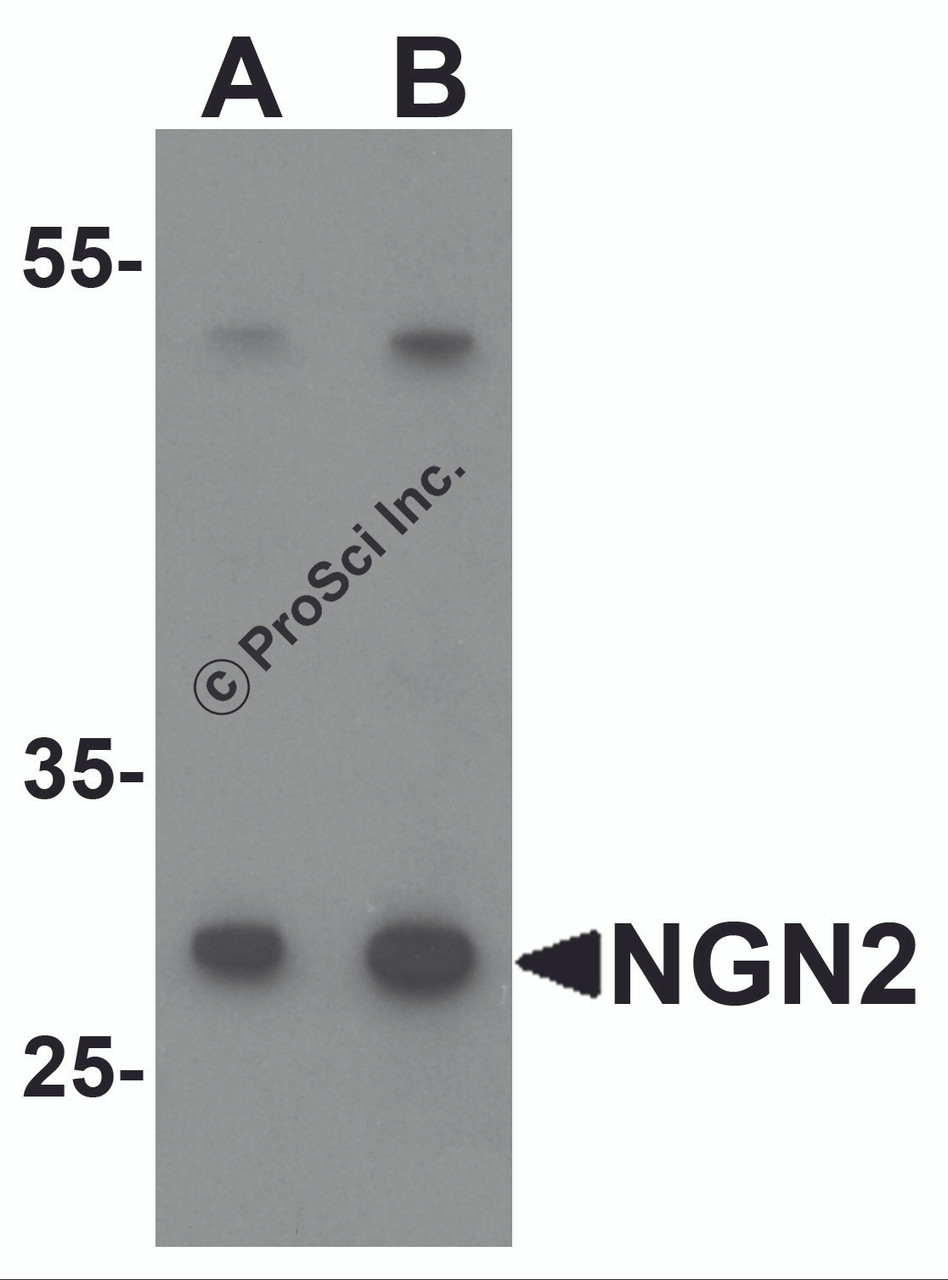 Western blot analysis of NGN2 in mouse small intestine tissue lysate with NGN2 antibody at (A) 1 and (B) 2 &#956;g/mL.