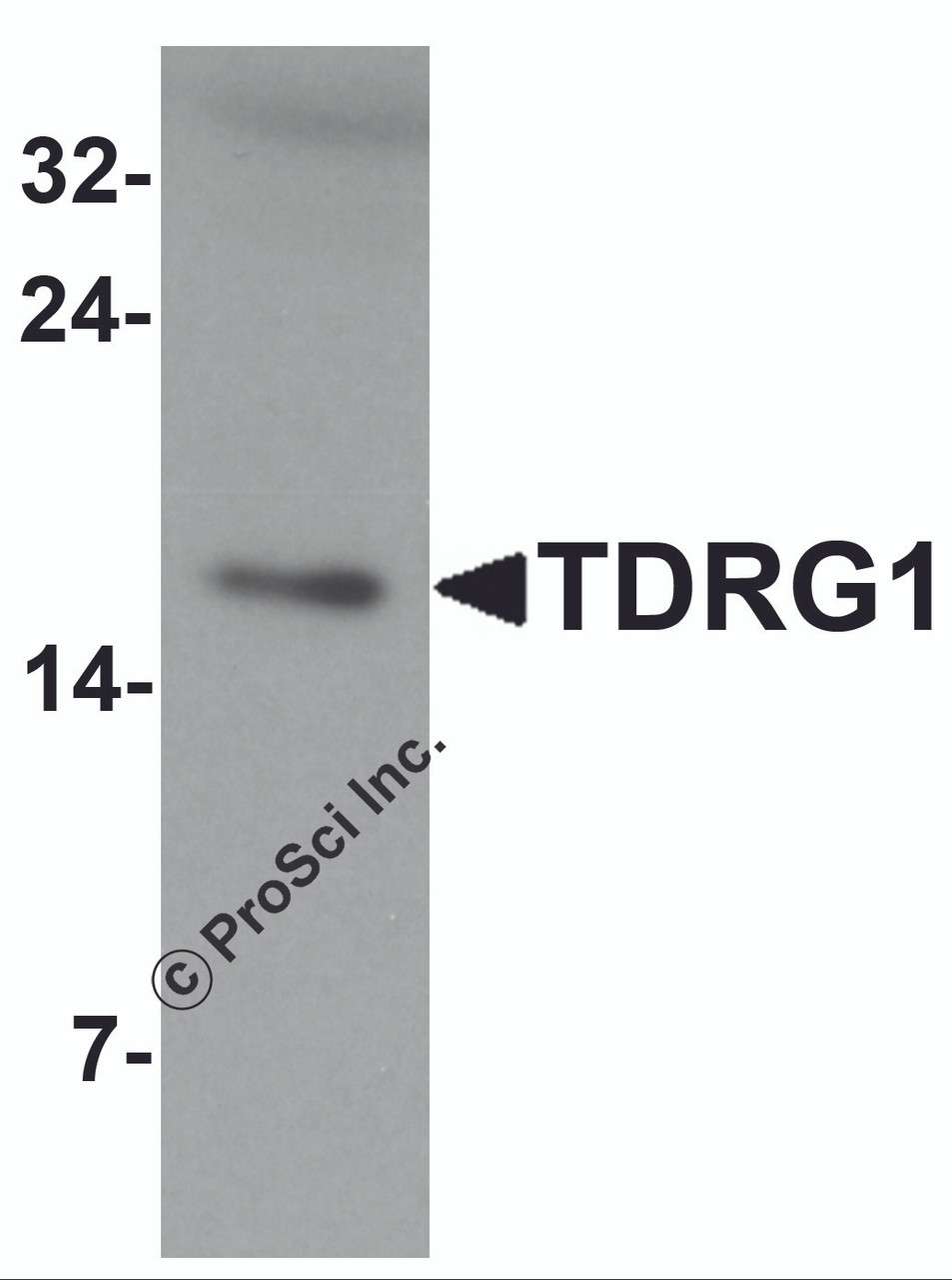 Western blot analysis of TDRG1 in human testis tissue lysate with TDRG1 antibody at 1 &#956;g/mL.