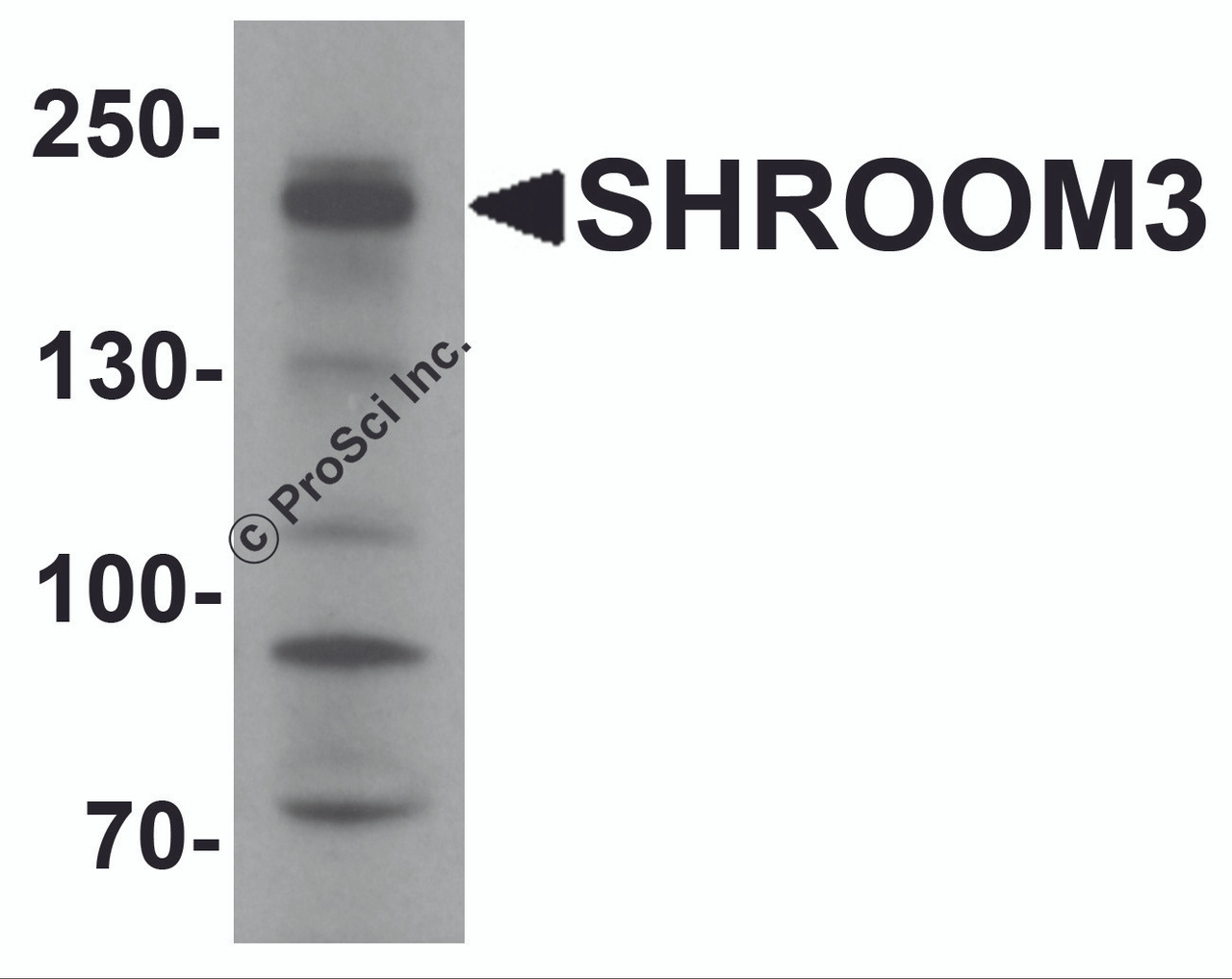Western blot analysis of SHROOM3 in SK-N-SH cell lysate with SHROOM3 antibody at 1 &#956;g/mL.