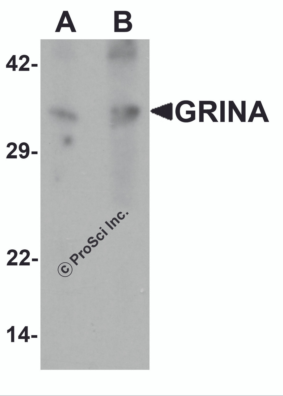 Western blot analysis of GRINA in human testis tissue lysate with GRINA antibody at (A) 1 and (B) 2 &#956;g/mL.