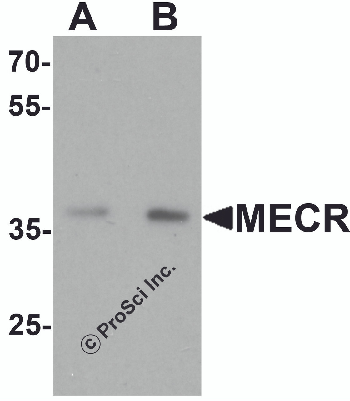 Western blot analysis of MECR in human brain tissue lysate with MECR antibody at (A) 1 and (B) 2 &#956;g/mL.