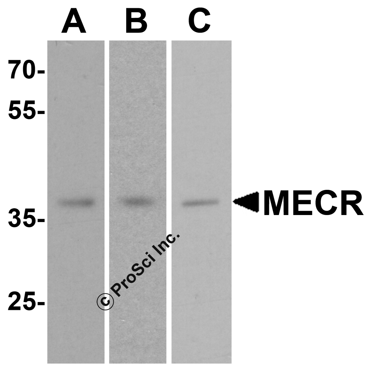 Western blot analysis of MECR in (A) human brain tissue, (B) mouse brain tissue, and (C) rat brain tissue lysate with MECR antibody at 1 ug/mL.