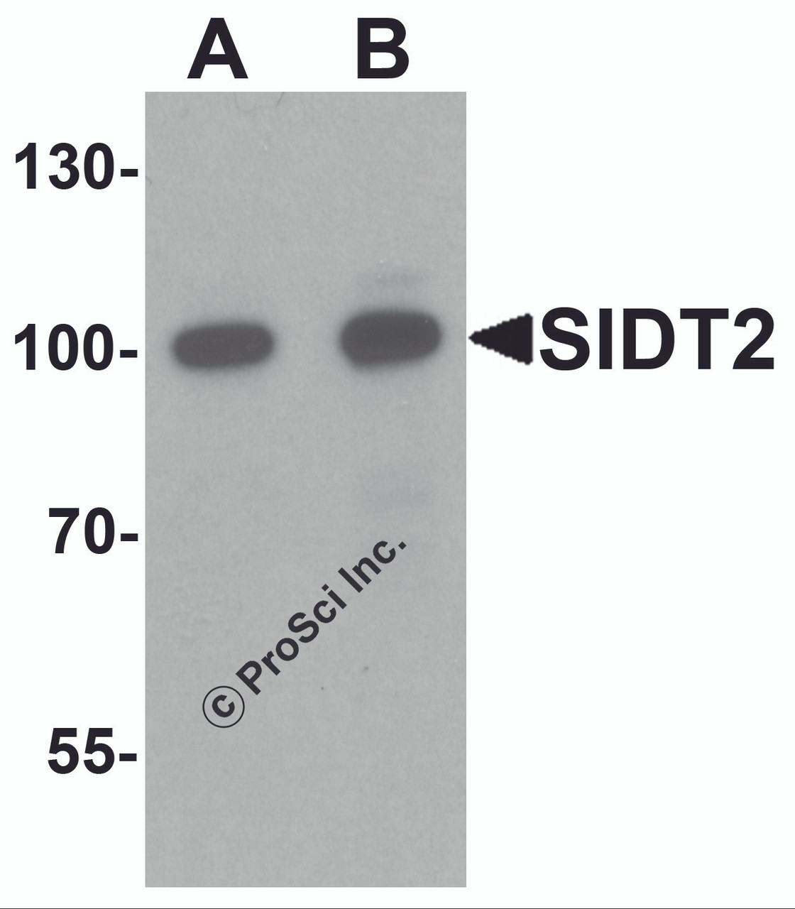Western blot analysis of SIDT2 in mouse brain tissue lysate with SIDT2 antibody at (A) 0.5 and (B) 1 &#956;g/mL.