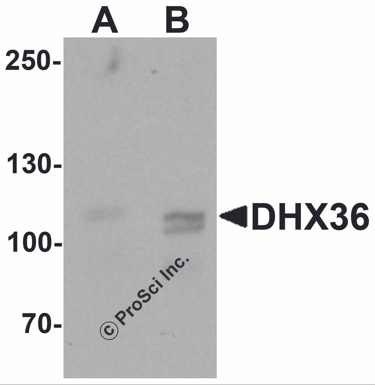 Western blot analysis of DHX36 in mouse liver tissue lysate with DHX36 antibody at (A) 0.5 and (B) 1 &#956;g/mL.