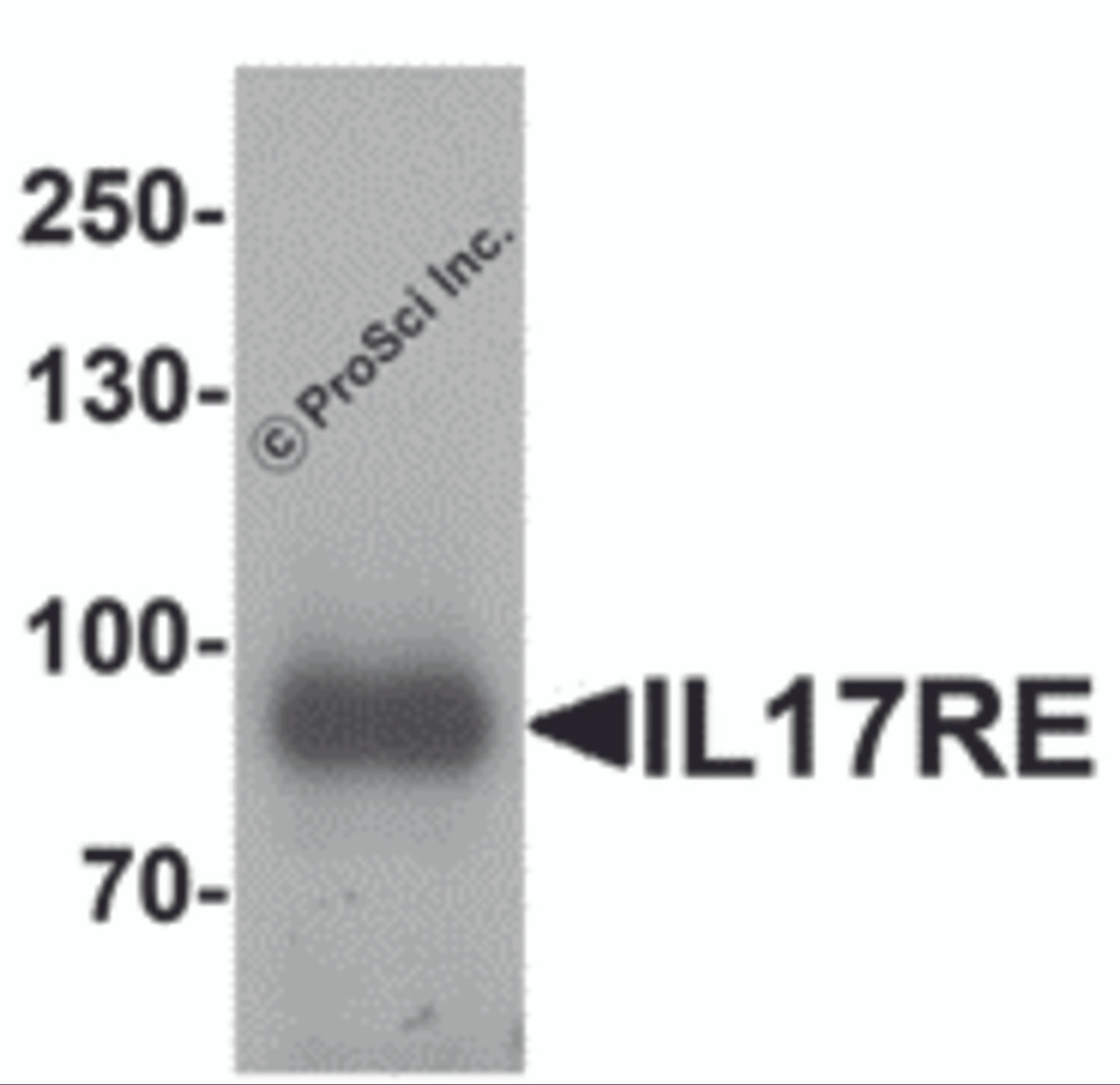 Western blot analysis of IL-17RE in human ovary tissue lysate with IL-17RE antibody at 1 &#956;g/mL.