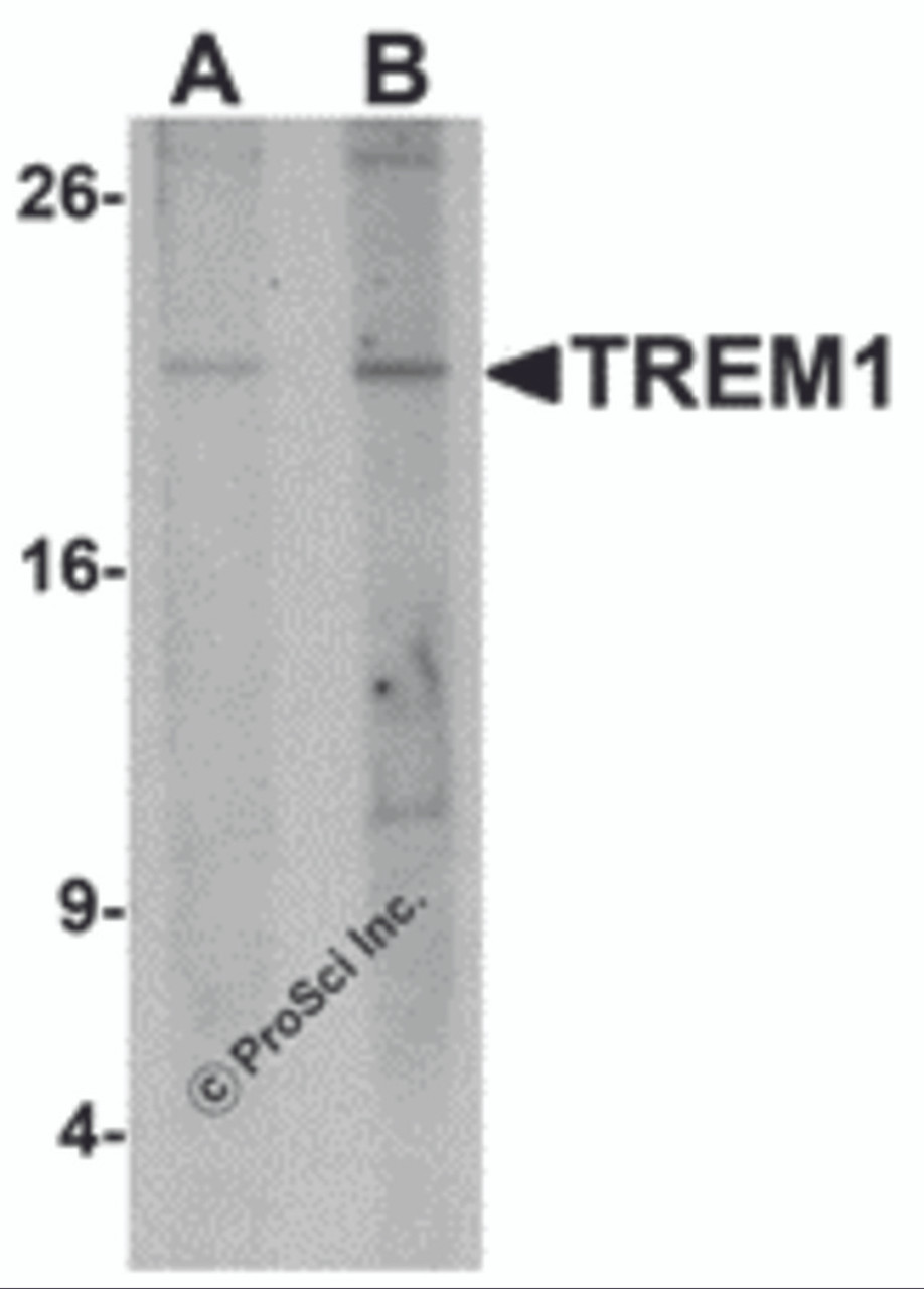 Western blot analysis of TREM1 in 293 cell lysate with TREM1 antibody at (A) 1 and (B) 2 &#956;g/mL.
