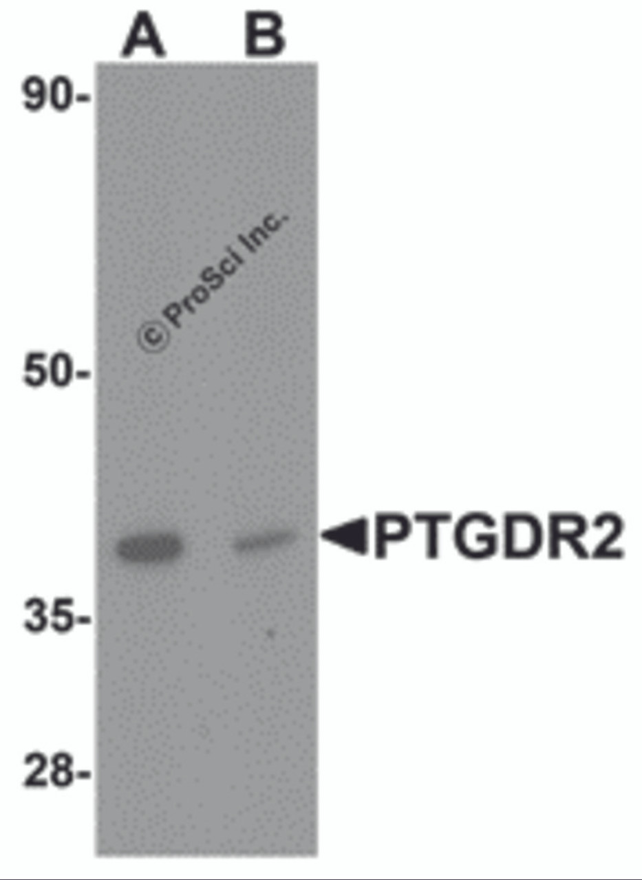 Western blot analysis of PTGDR2 in small intestine tissue lysate with PTGDR2 antibody at 1 &#956;g/mL in (A) the absence and (B) the presence of blocking peptide.