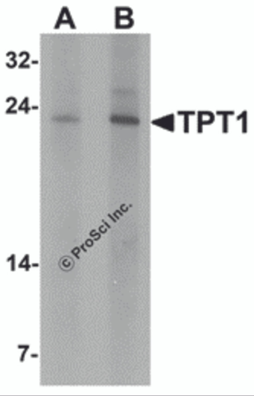 Western blot analysis of TPT1 in human brain tissue lysate with TPT1 antibody at (A) 0.5 and (B) 1 &#956;g/mL.