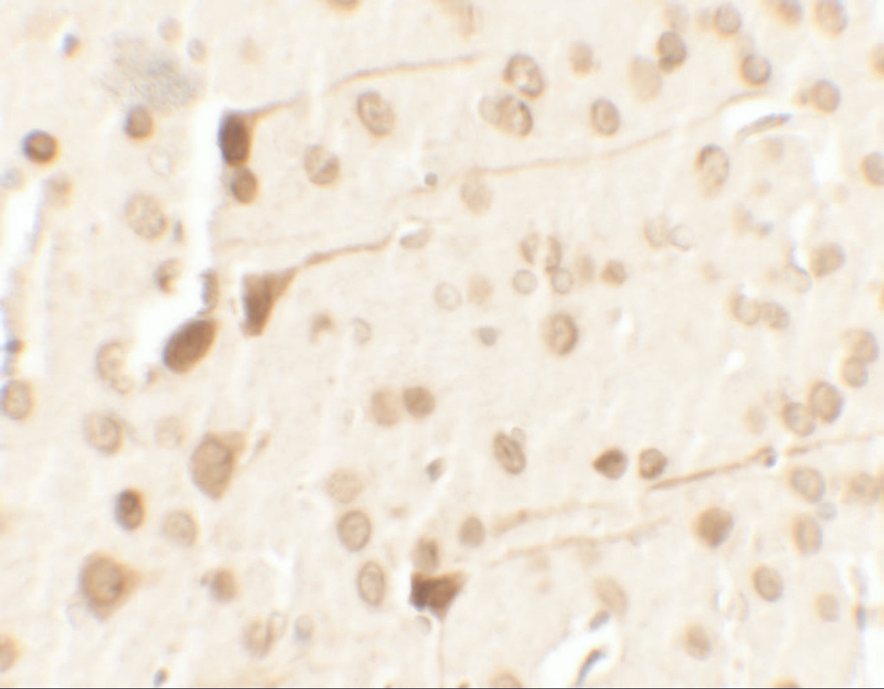 Immunohistochemistry of TPT1 in rat brain tissue with TPT1 antibody at 2.5 ug/ml.