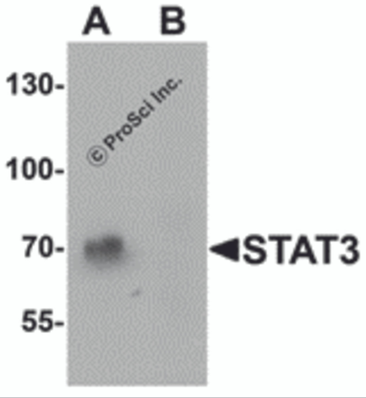 Western blot analysis of STAT3 in human small intestine tissue lysate with STAT3 antibody at 1 &#956;g/mL in (A) the absence and (B) the presence of blocking peptide.