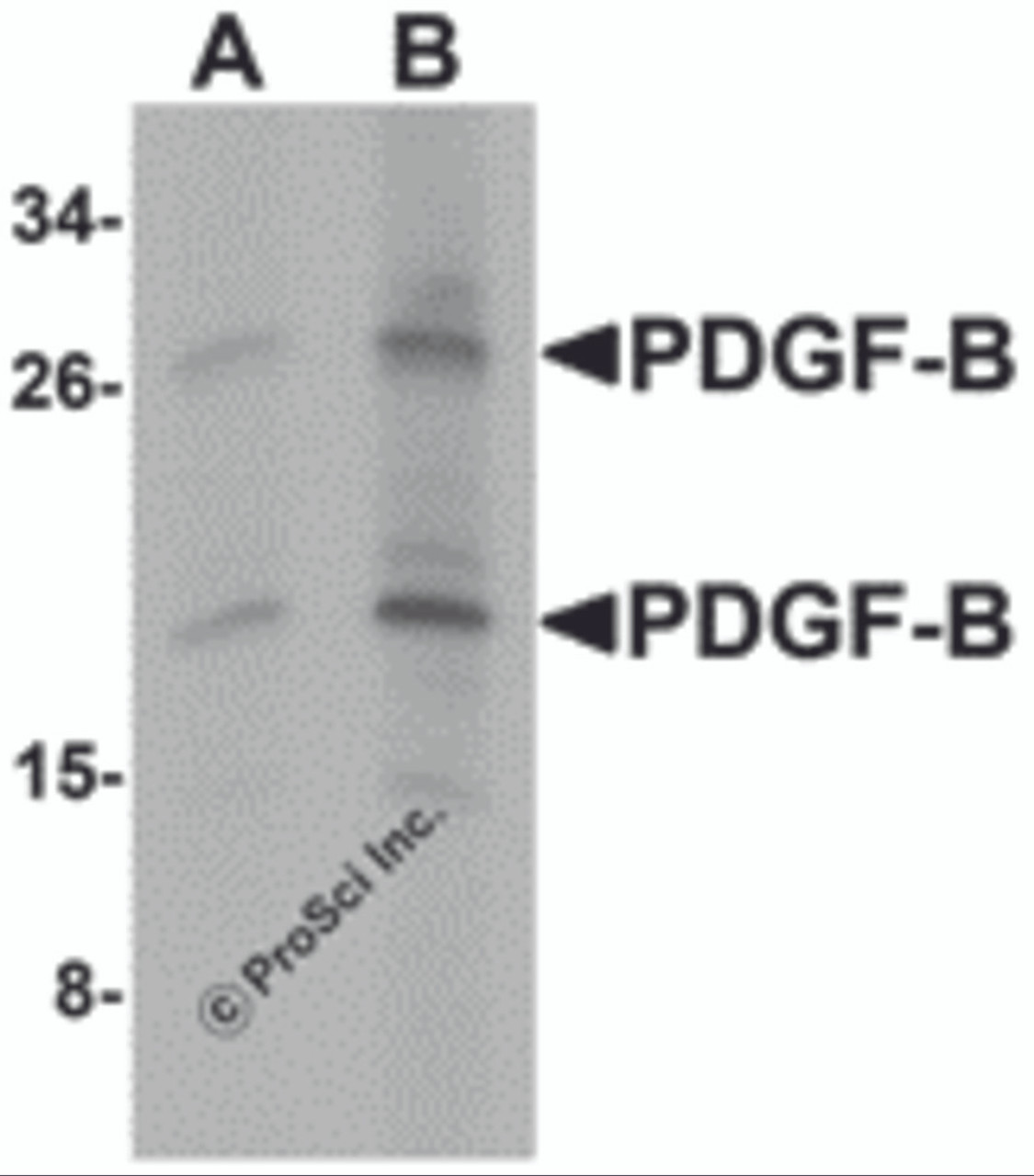Western blot analysis of PDGF-B in rat liver tissue lysate with PDGF-B antibody at (A) 1 and (B) 2 &#956;g/mL.