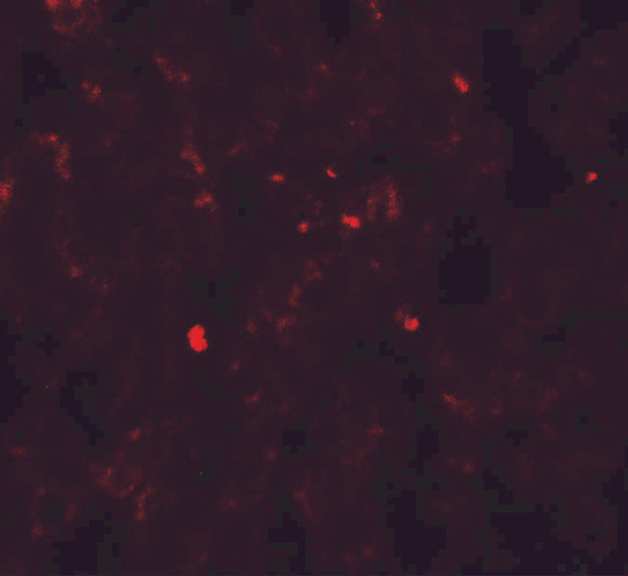 Immunofluorescence of PDGF-B in human liver tissue with PDGF-B antibody at 20 ug/ml.