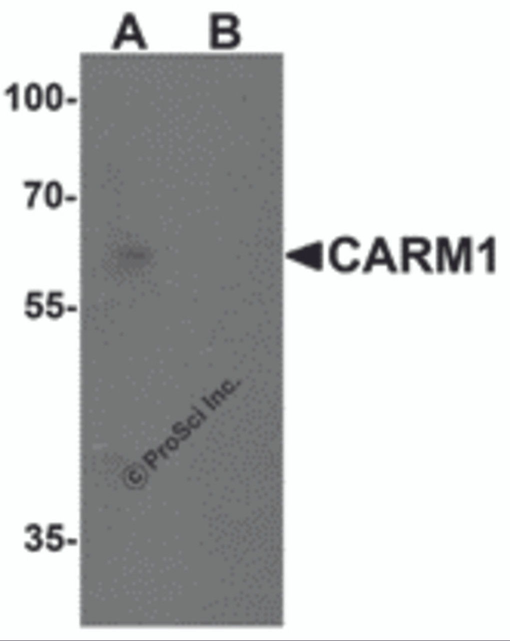 Western blot analysis of CARM1 in Jurkat cell lysate with CARM1 antibody at 1 &#956;g/mL in (A) the absence and (B) the presence of blocking peptide.
