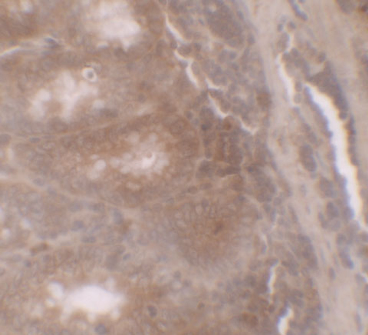 Immunohistochemistry of TSC22D3 in human small intestine tissue with TSC22D3 antibody at 5 ug/ml.