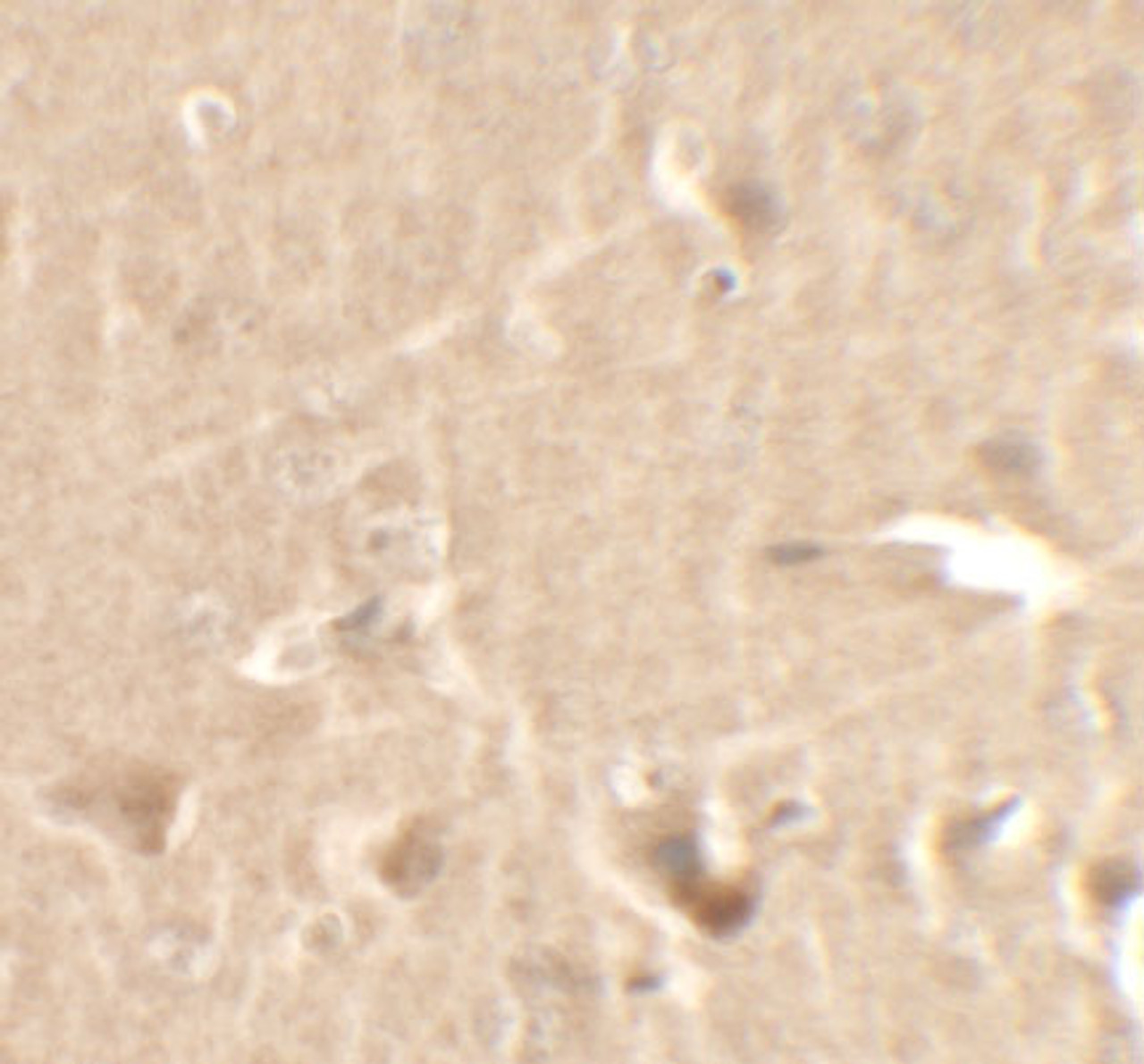 Immunohistochemistry of CCNT1 in rat brain tissue with CCNT1 antibody at 2.5 ug/ml.