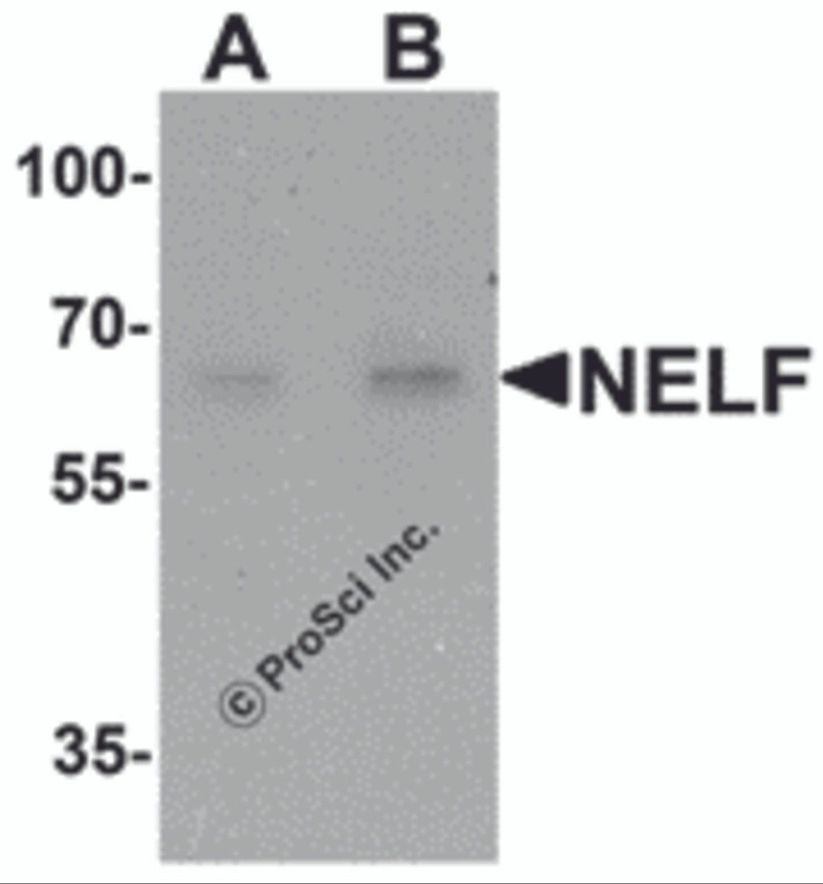 Western blot analysis of NELF in Hela cell lysate with NELF antibody at (A) 1 and (B) 2 &#956;g/mL.