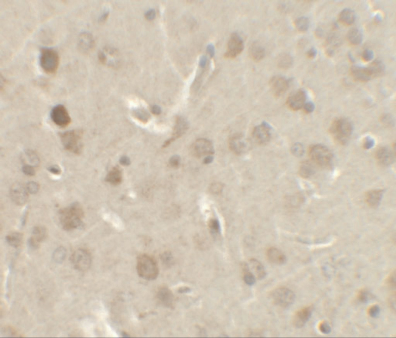 Immunohistochemistry of NELF in rat brain tissue with NELF antibody at 2.5 ug/ml.