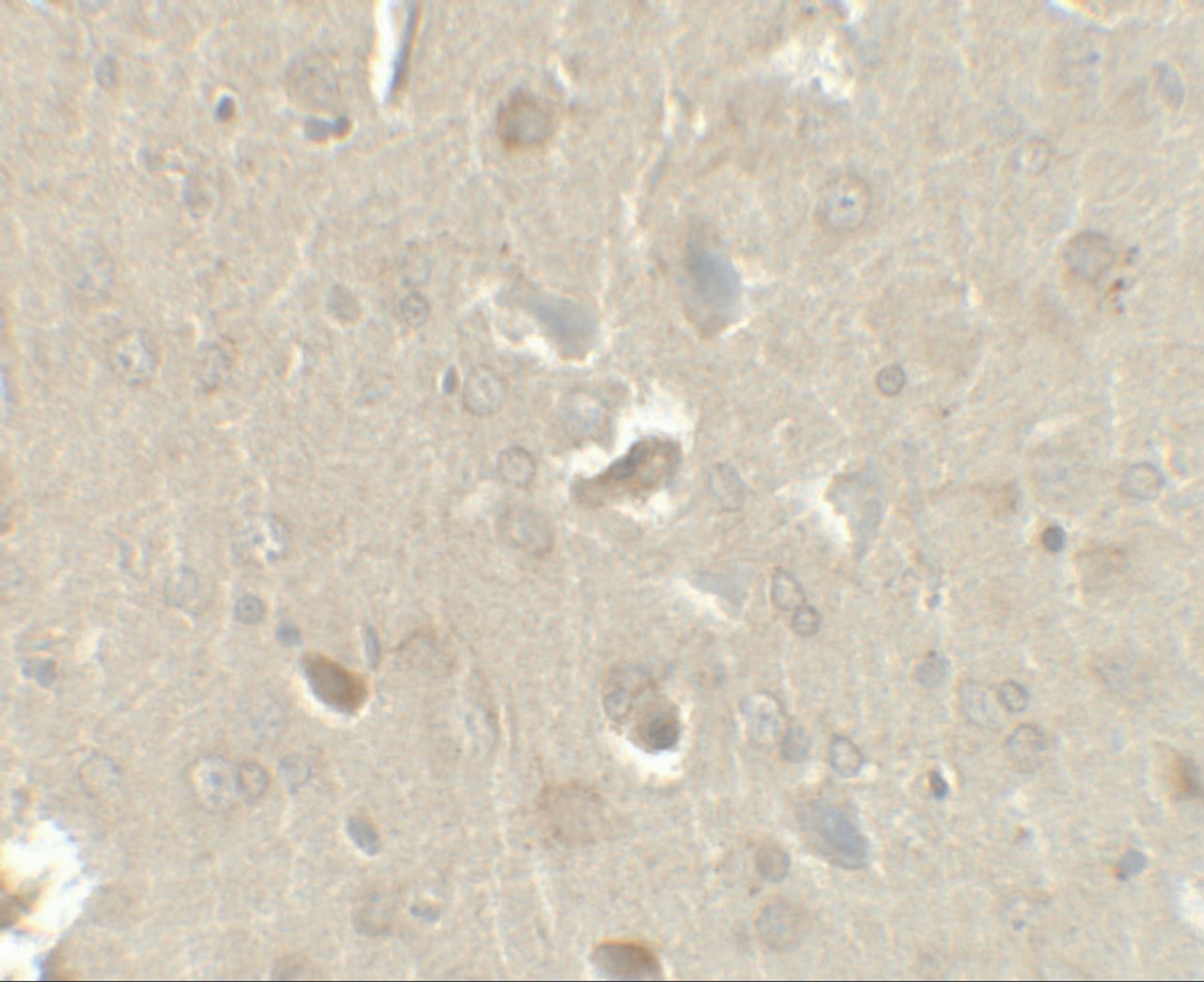 Immunohistochemistry of CCL4 in rat brain tissue with CCL4 antibody at 2.5 ug/ml.
