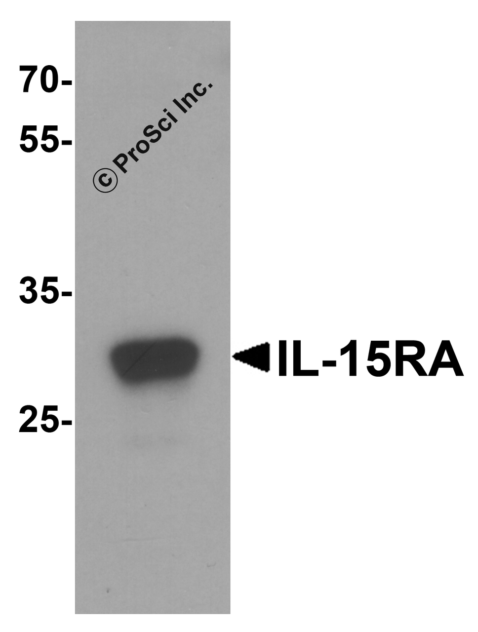 Western blot analysis of IL-15RA in rat small intestine tissue lysate with IL-15RA antibody at 1 &#956;g/mL.