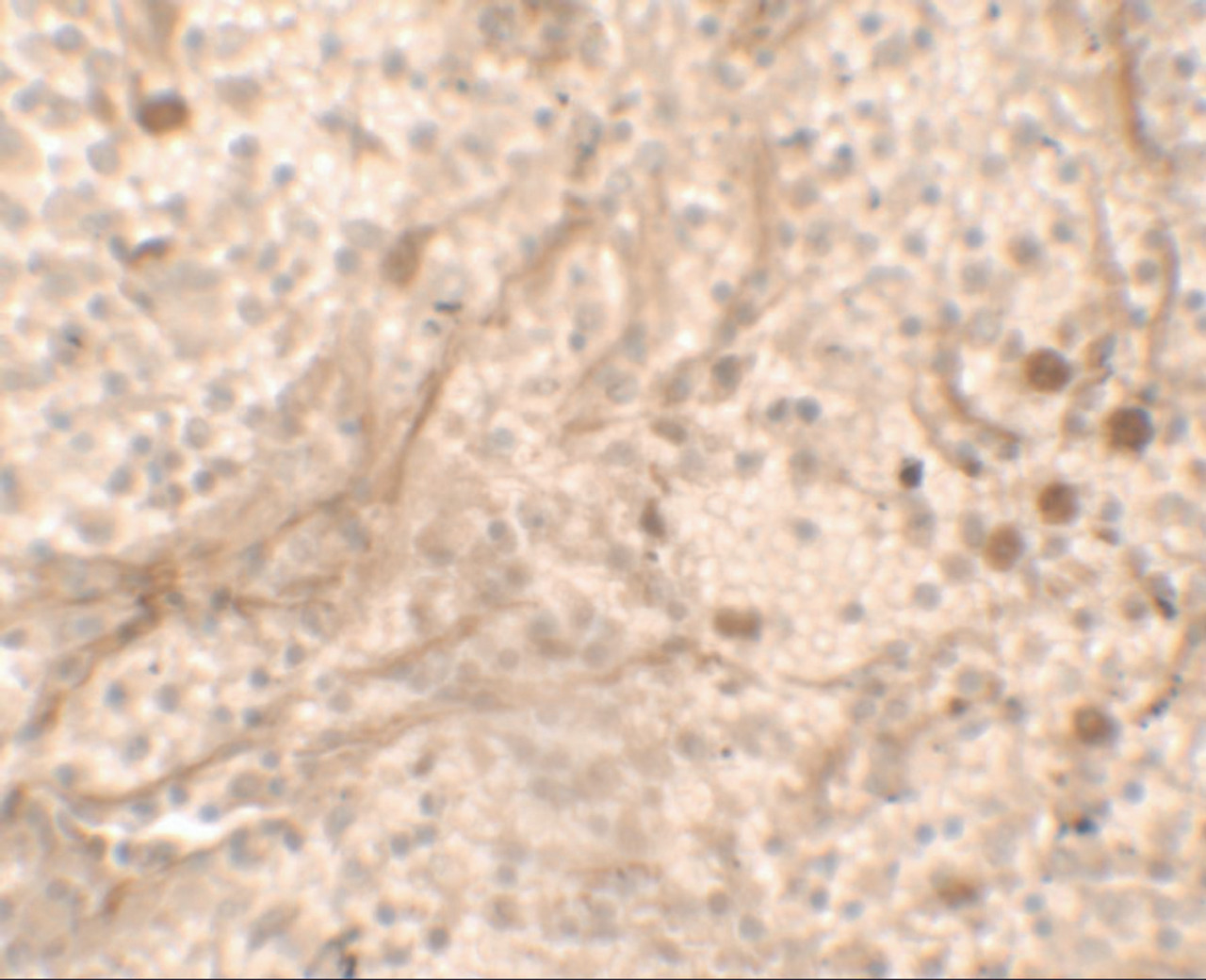 Immunohistochemistry of PBIF in human spleen tissue with PBIF antibody at 5 ug/ml.