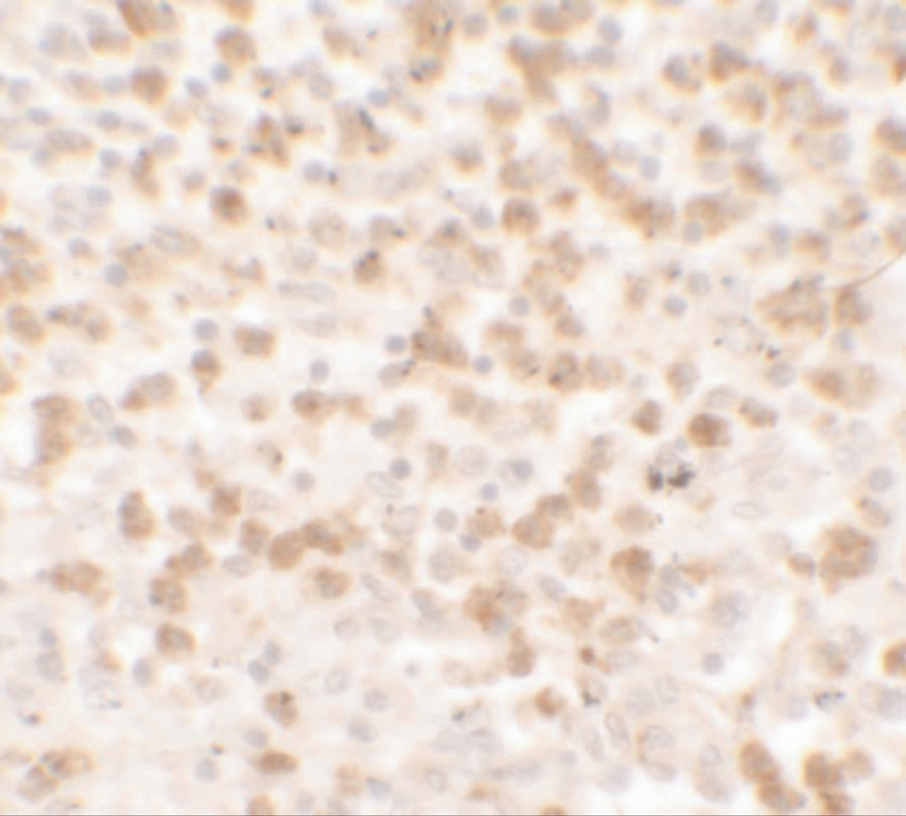 Immunohistochemistry of CCL17 in human spleen tissue with CCL17 antibody at 5 ug/ml.