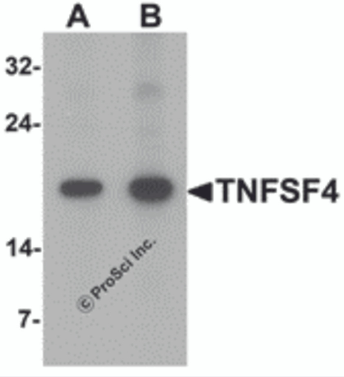 Western blot analysis of TNFSF4 in rat spleen tissue lysate with TNFSF4 antibody at (A) 0.5 and (B) 1 &#956;g/mL