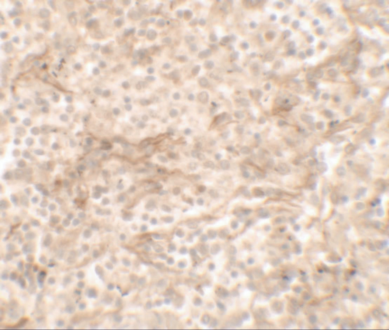 Immunohistochemistry of TNFSF4 in human spleen tissue with TNFSF4 antibody at 5 ug/ml.