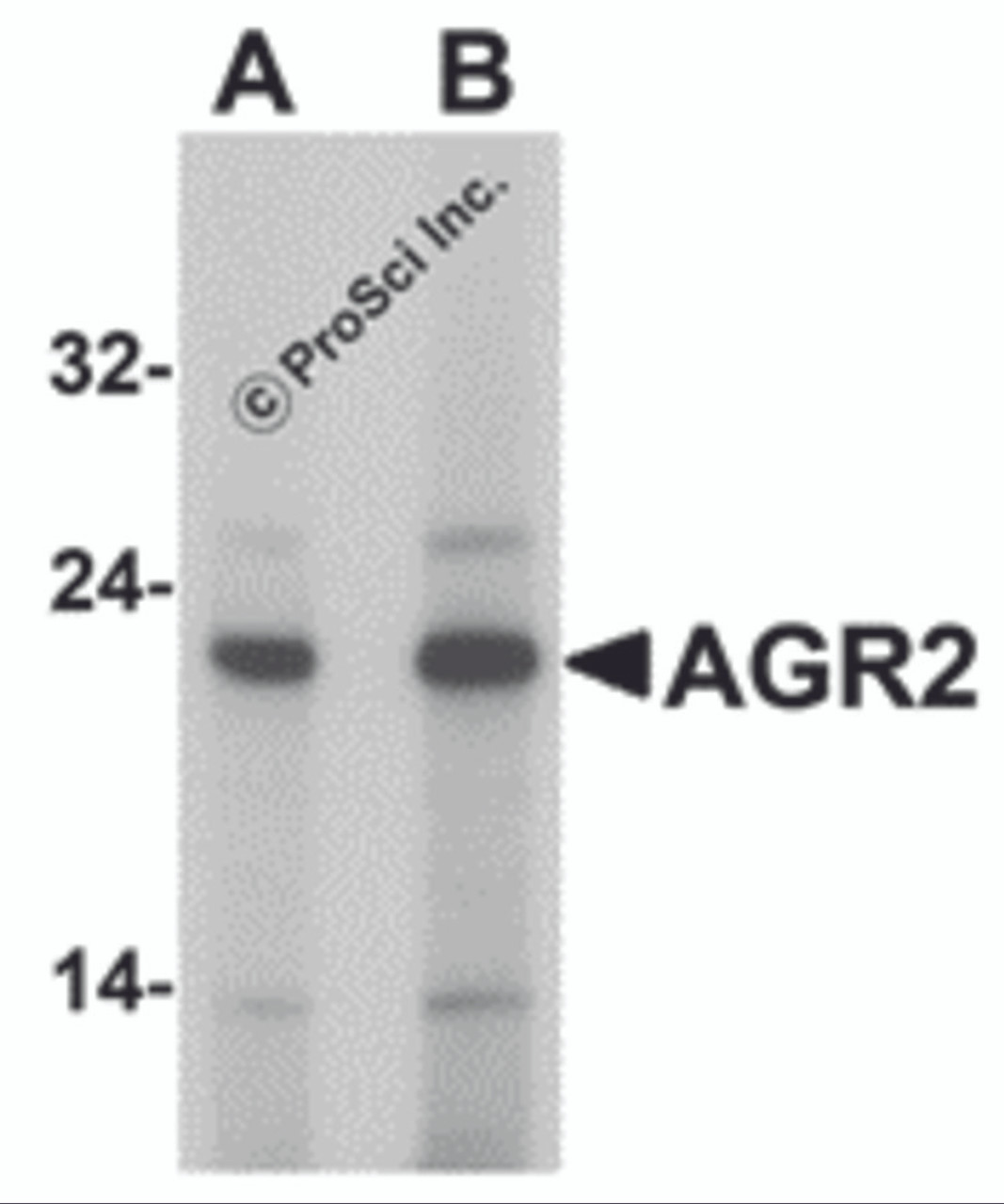 Western blot analysis of AGR2 in Hela cell lysate with AGR2 antibody at (A) 1 and (B) 2 &#956;g/mL