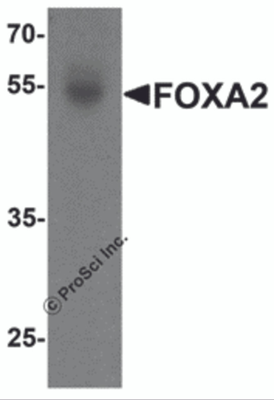 Western blot analysis of FOXA2 in human bladder tissue lysate with FOXA2 antibody at 1 &#956;g/mL.