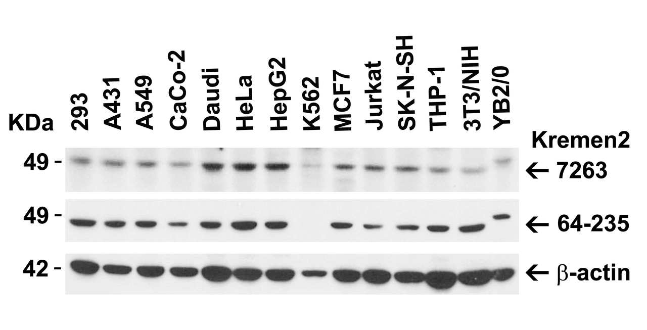 Figure 1 Independent Antibody Validation (IAV) via Protein Expression Profile in Human, Mouse and Rat Cell Lines
Loading: 15 &#956;g of lysates per lane.
Antibodies: KREMEN2, 7263 (2 &#956;g/mL) , KREMEN2, 64-235 (1 &#956;g/mL) and beta-actin, 3779 (2 &#956;g/mL) , 1h incubation at RT in 5% NFDM/TBST.
Secondary: Goat anti-rabbit IgG HRP conjugate at 1:10000 dilution.