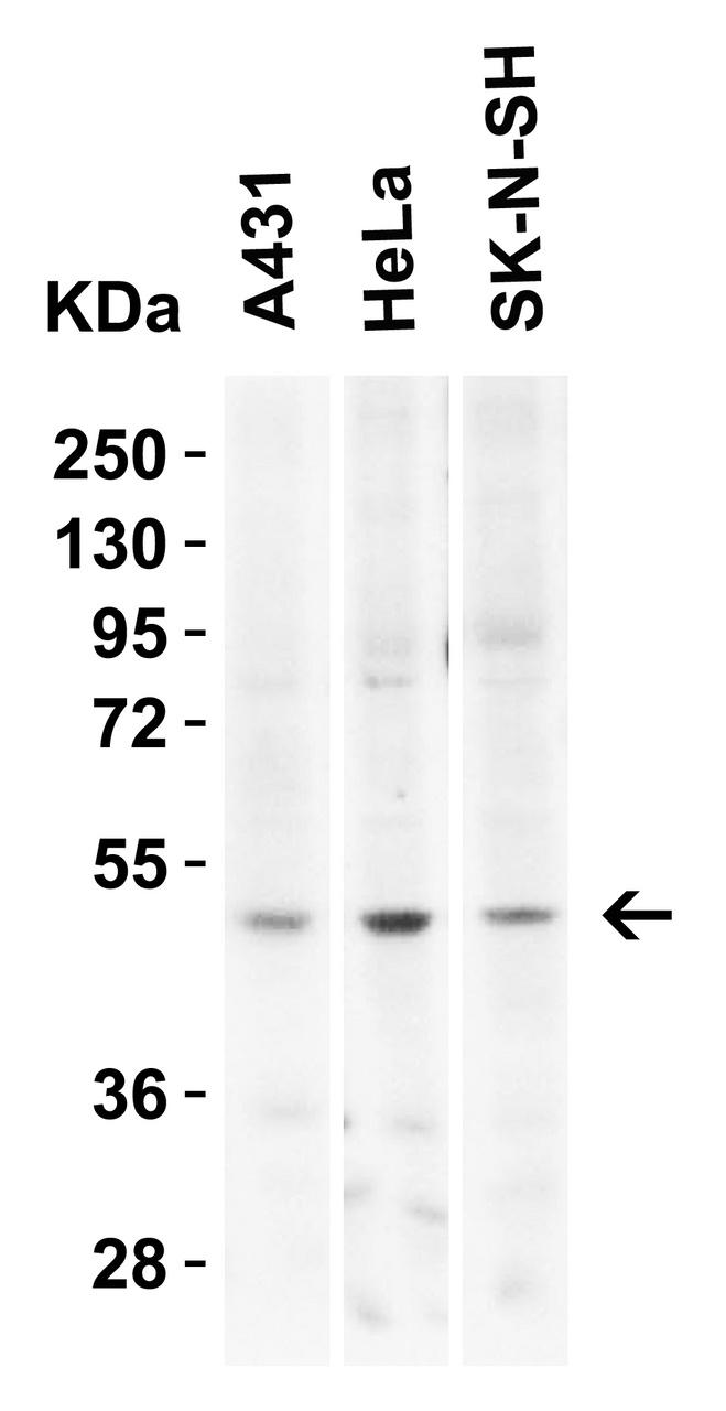 Figure 2 Western Blot Validation in Human Cell Lines
Loading: 15 ug of lysates per lane.
Antibodies: KREMEN2, 7263 (2 ug/mL) , 1h incubation at RT in 5% NFDM/TBST.
Secondary: Goat anti-rabbit IgG HRP conjugate at 1:10000 dilution.