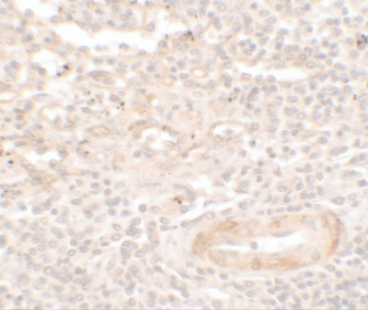 Immunohistochemistry of SDPR in human spleen tissue with SDPR antibody at 5 ug/ml.