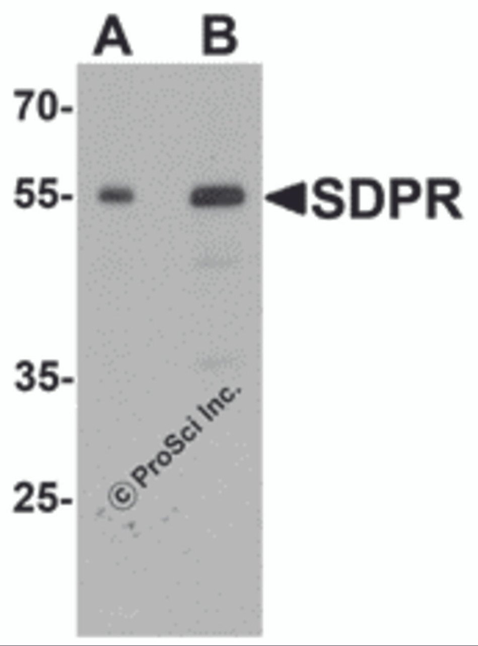 Western blot analysis of PTRF in human spleen tissue lysate with PTRF antibody at (A) 0.5 and (B) 1 &#956;g/mL