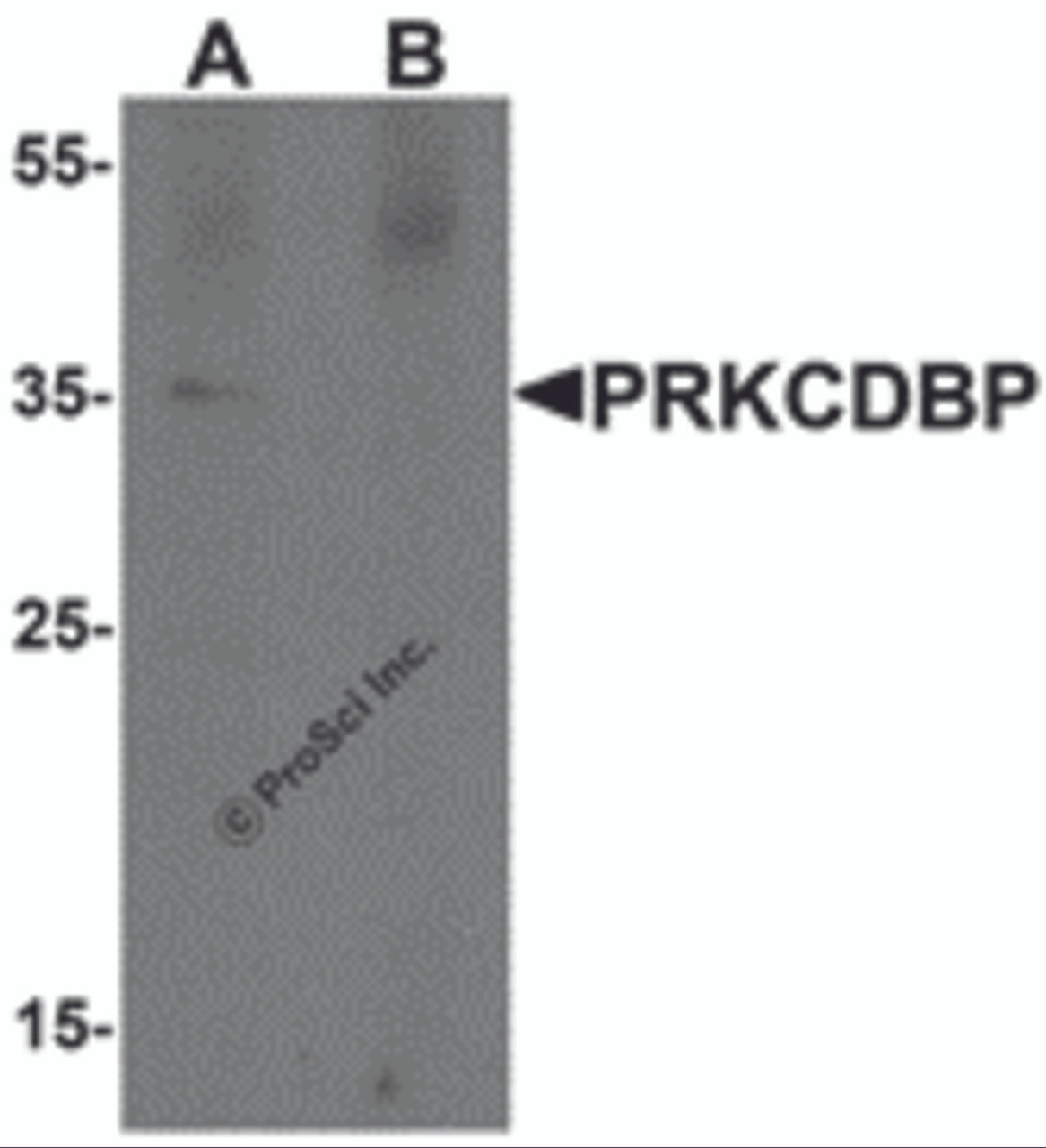 Western blot analysis of PRKCDBP in A20 cell lysate with PRKCDBP antibody at 1 &#956;g/mL in (A) the absence and (B) the presence of blocking peptide.