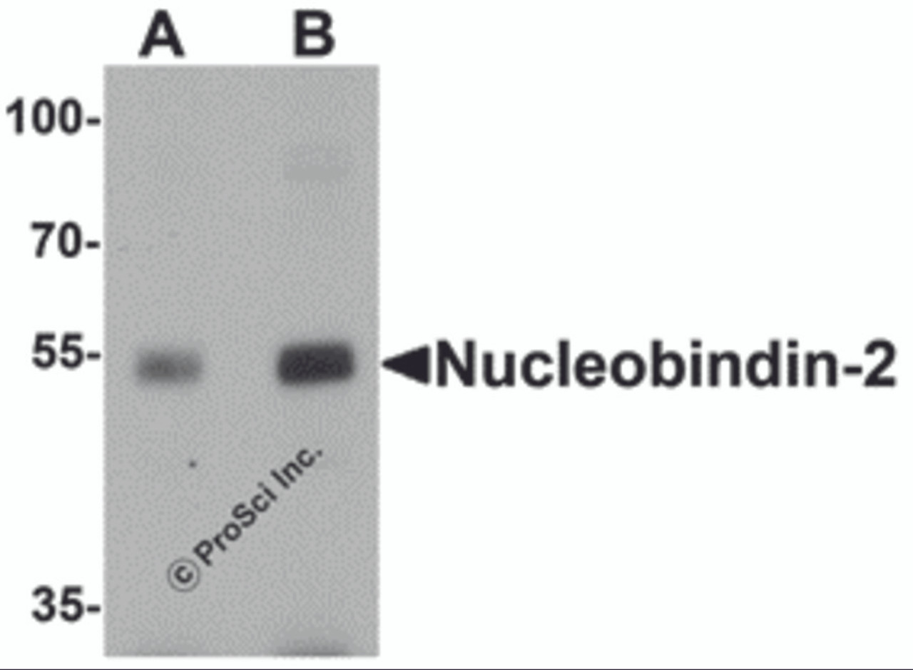 Western blot analysis of Nucleobindin-2 in rat brain tissue lysate with Nucleobindin-2 antibody at (A) 0.5 and (B) 1 &#956;g/mL.