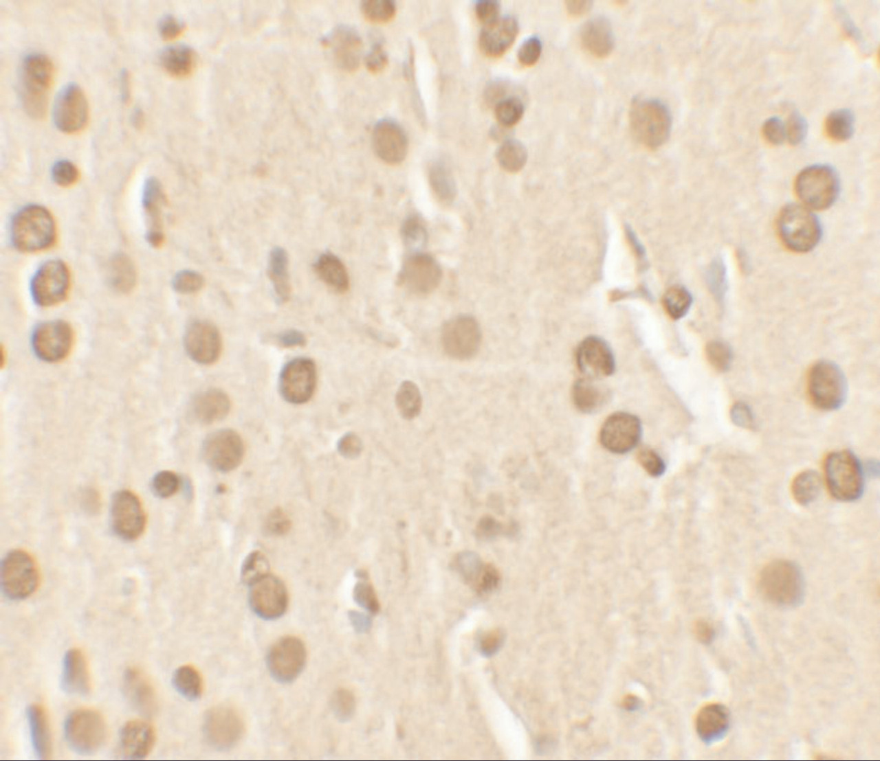 Immunohistochemistry of Nucleobindin-2 in rat brain tissue with Nucleobindin-2 antibody at 2.5 ug/ml.