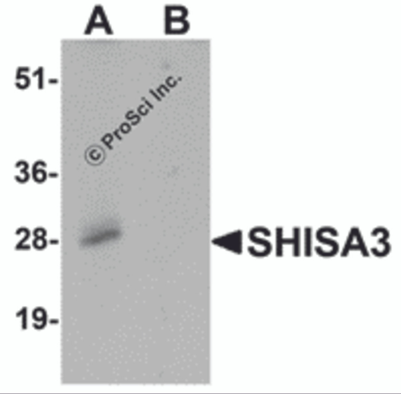 Western blot analysis of SHISA3 in human small intestine Tissue lysate with SHISA3 antibody at 1 &#956;g/mL in (A) the absence and (B) the presence of blocking peptide.