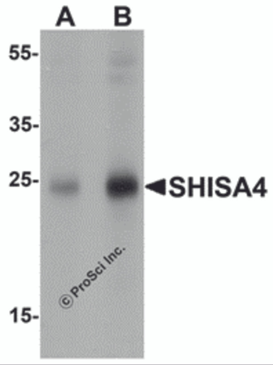 Western blot analysis of SHISA4 in human brain tissue lysate with SHISA4 antibody at (A) 1 and (B) 2 &#956;g/mL.