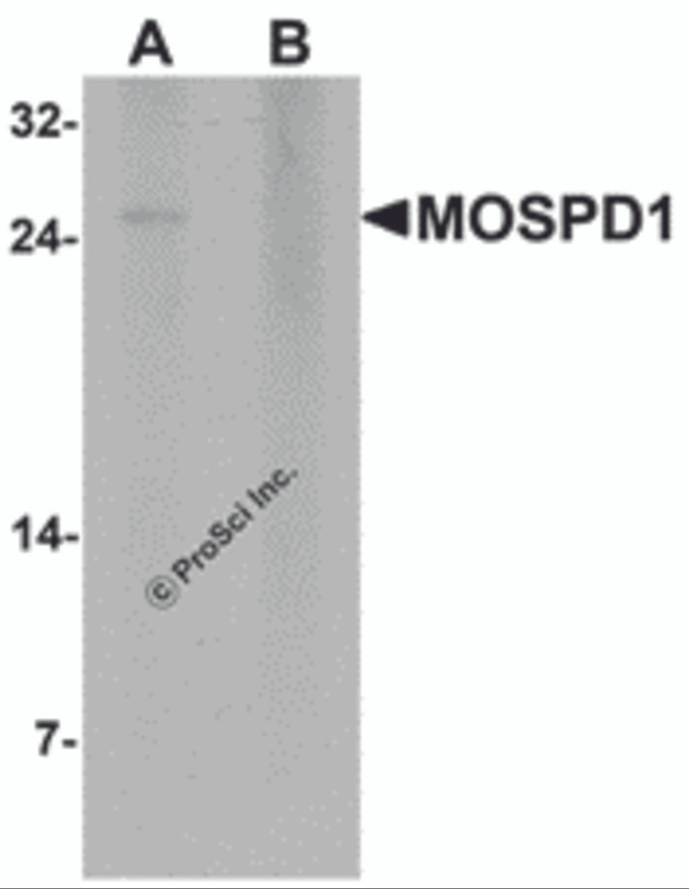 Western blot analysis of MOSPD1 in human brain tissue lysate with MOSPD1 antibody at 1 &#956;g/mL in (A) the absence and (B) the presence of blocking peptide.