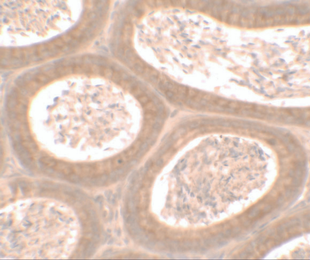 Immunohistochemistry of MOSPD1 in mouse testis tissue with MOSPD1 antibody at 2.5 ug/ml.