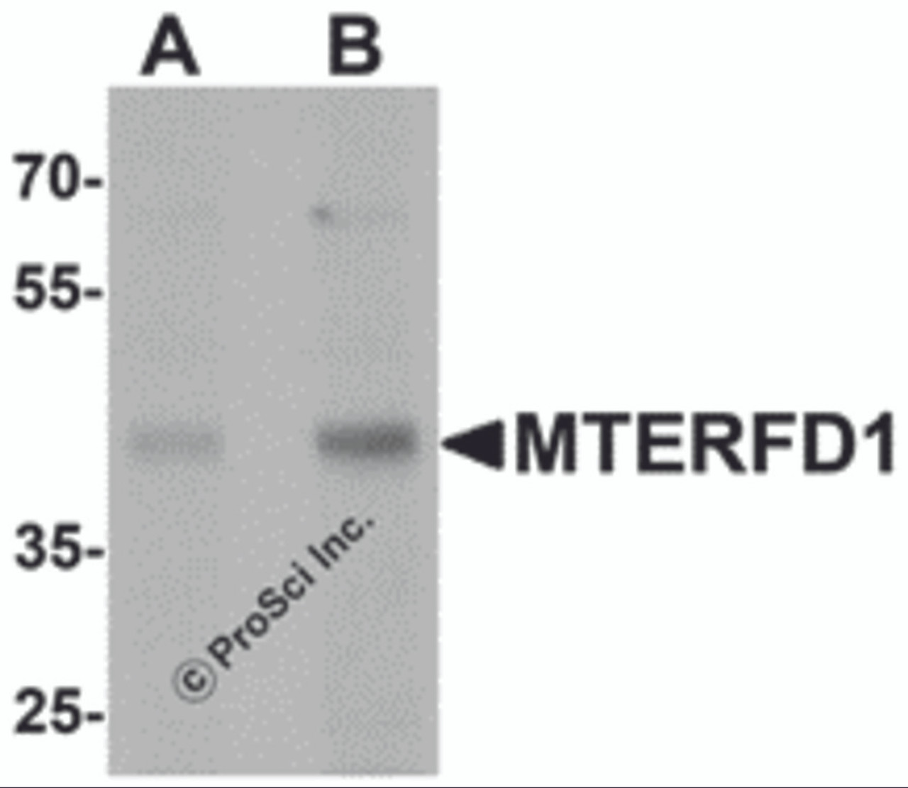 Western blot analysis of MTERFD1 in 3T3 cell lysate with MTERFD1 antibody at (A) 1 and (B) 2 &#956;g/mL.