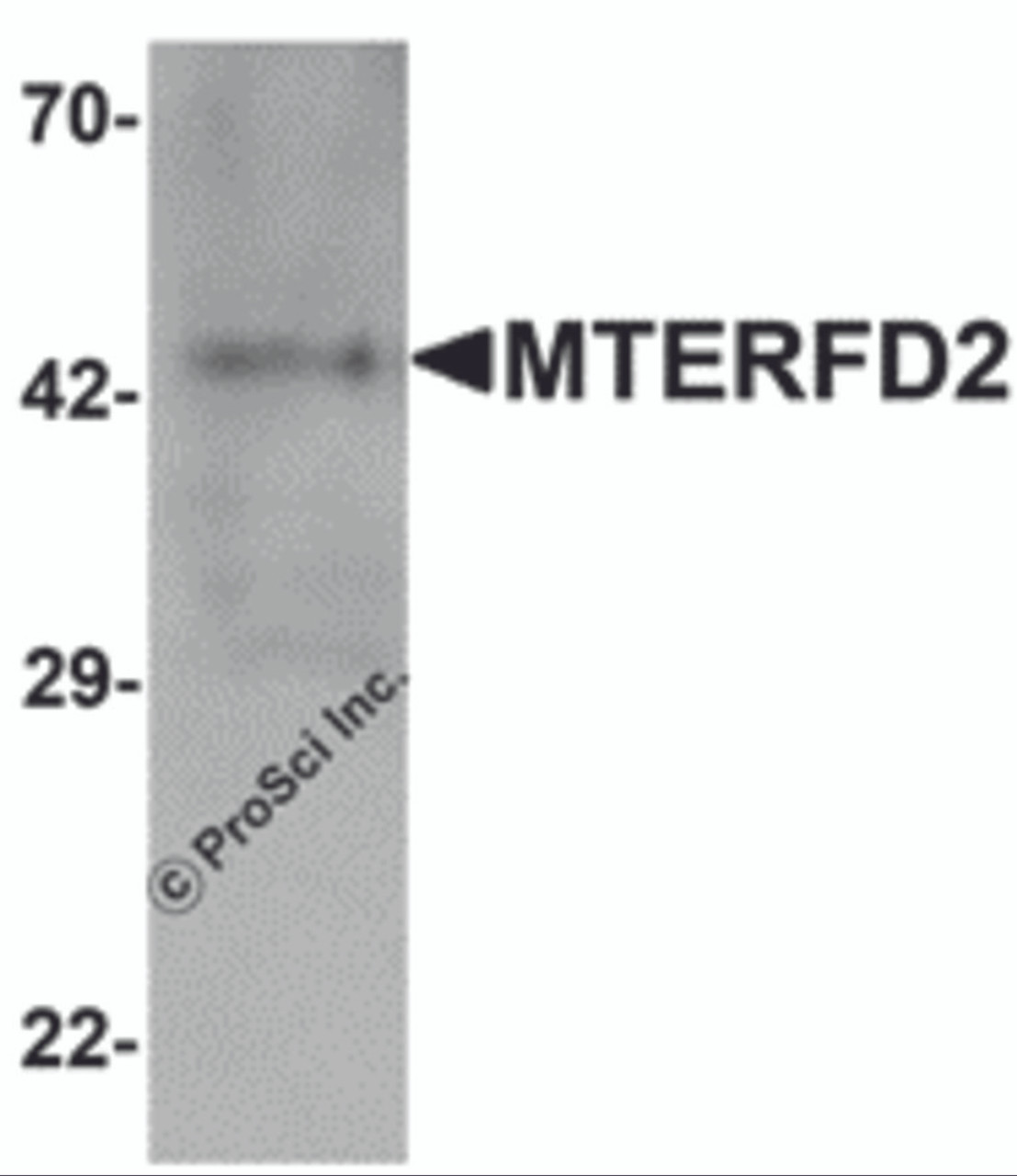 Western blot analysis of MTERFD2 in human small intestine tissue lysate with MTERFD2 antibody at 1 &#956;g/mL.