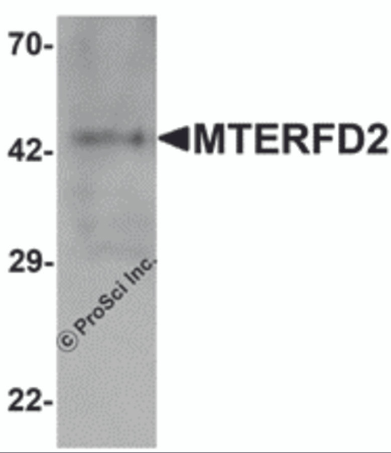 Western blot analysis of MTERFD2 in human small intestine tissue lysate with MTERFD2 antibody at 1 μg/mL.