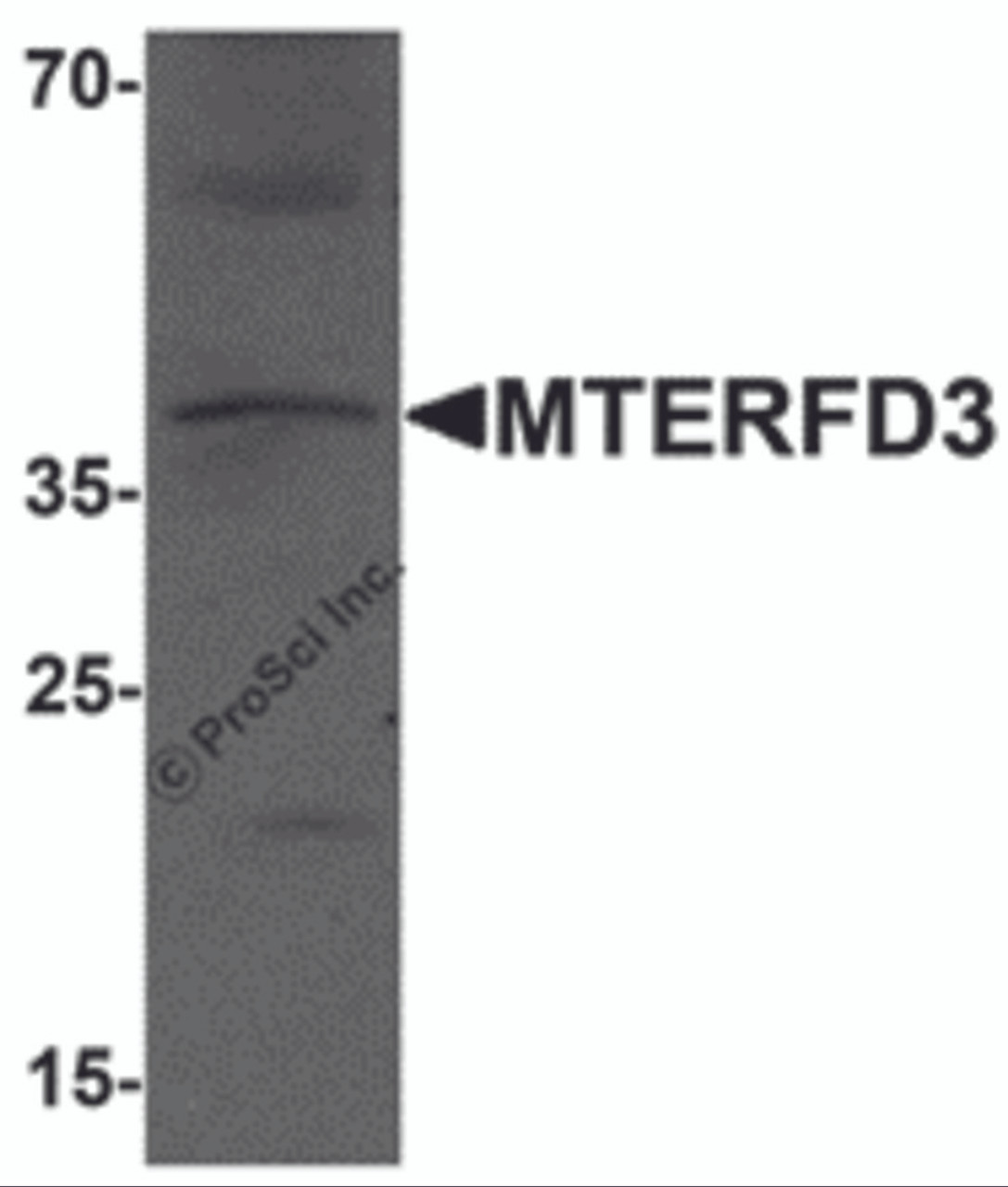 Western blot analysis of MTERFD3 in human testis tissue lysate with MTERFD3 antibody at 1 &#956;g/mL.
