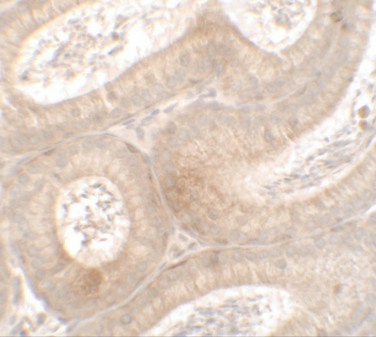 Immunohistochemistry of MTERFD3 in mouse testis tissue with MTERFD3 antibody at 2.5 ug/ml.