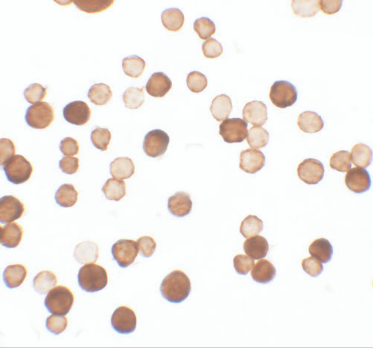 Immunocytochemistry of ERRF in HeLa cells with ERRF antibody at 2.5 ug/ml.