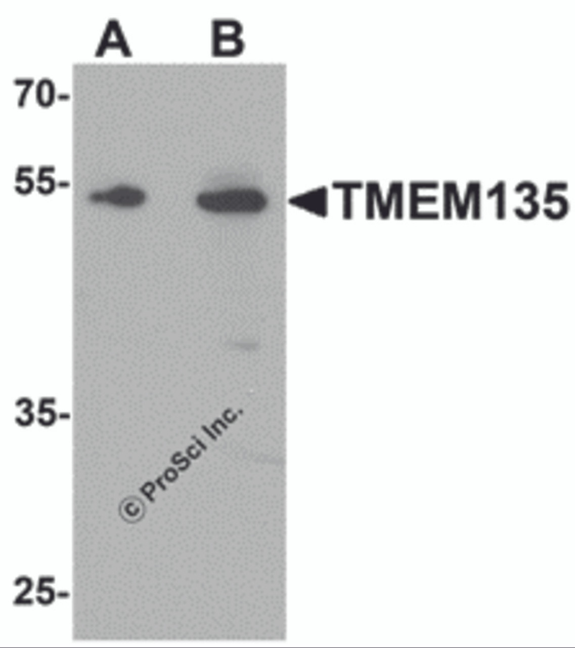 Western blot analysis of TMEM135 in rat liver tissue lysate with TMEM135 antibody at (A) 1 and (B) 2 &#956;g/mL.